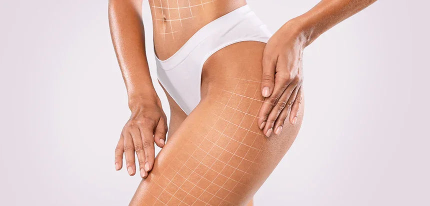 Kit Rimodellante Intensivo Adipe Cell + Collant Fosfatidilcolina: La Soluzione Completa per Cellulite